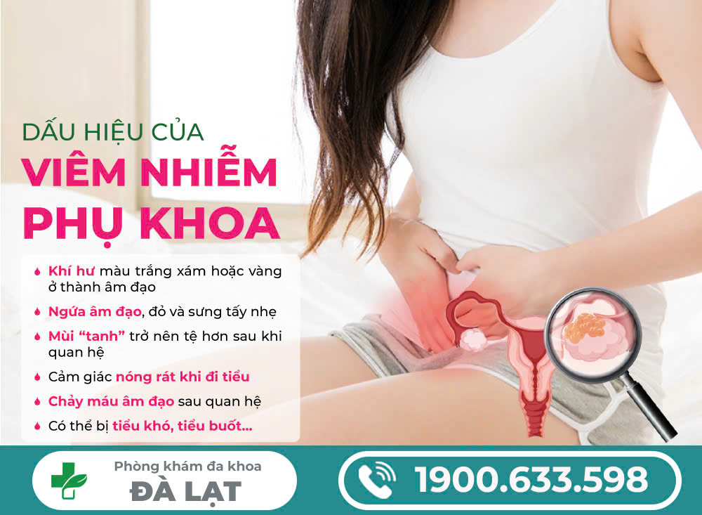 Hình ảnh minh họa